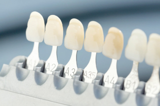 ホワイトニング